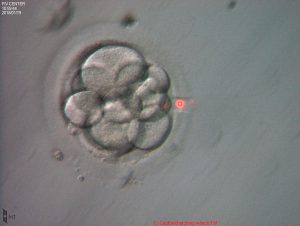 tratamientos-hatching-asistido-tecnica