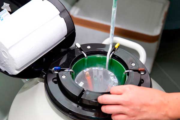 Edad para congelar óvulos ideal