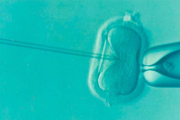 Diferencia entre fiv e isci