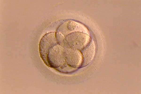 Fecundación in Vitro proceso